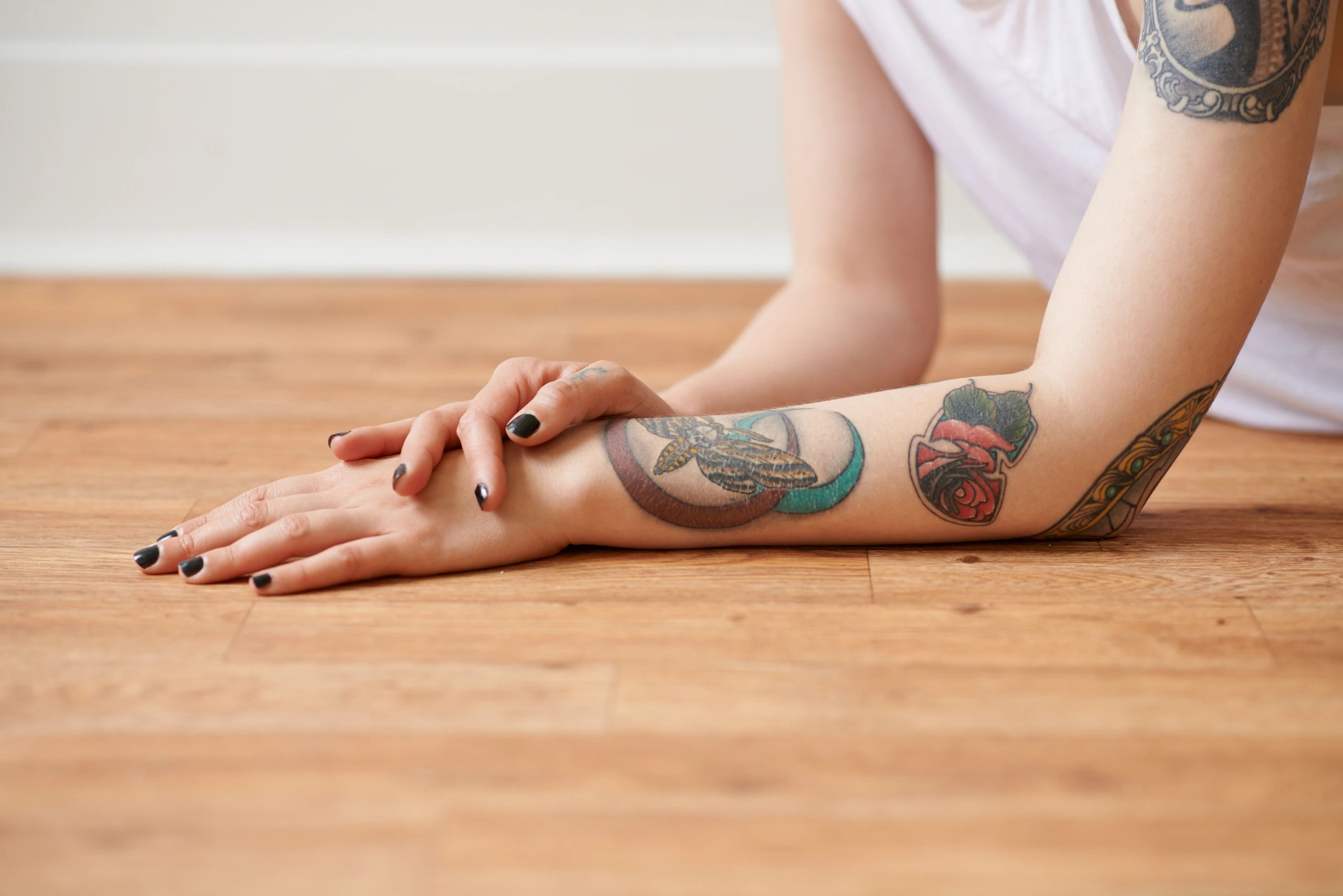 tattoo removal laser dermatology